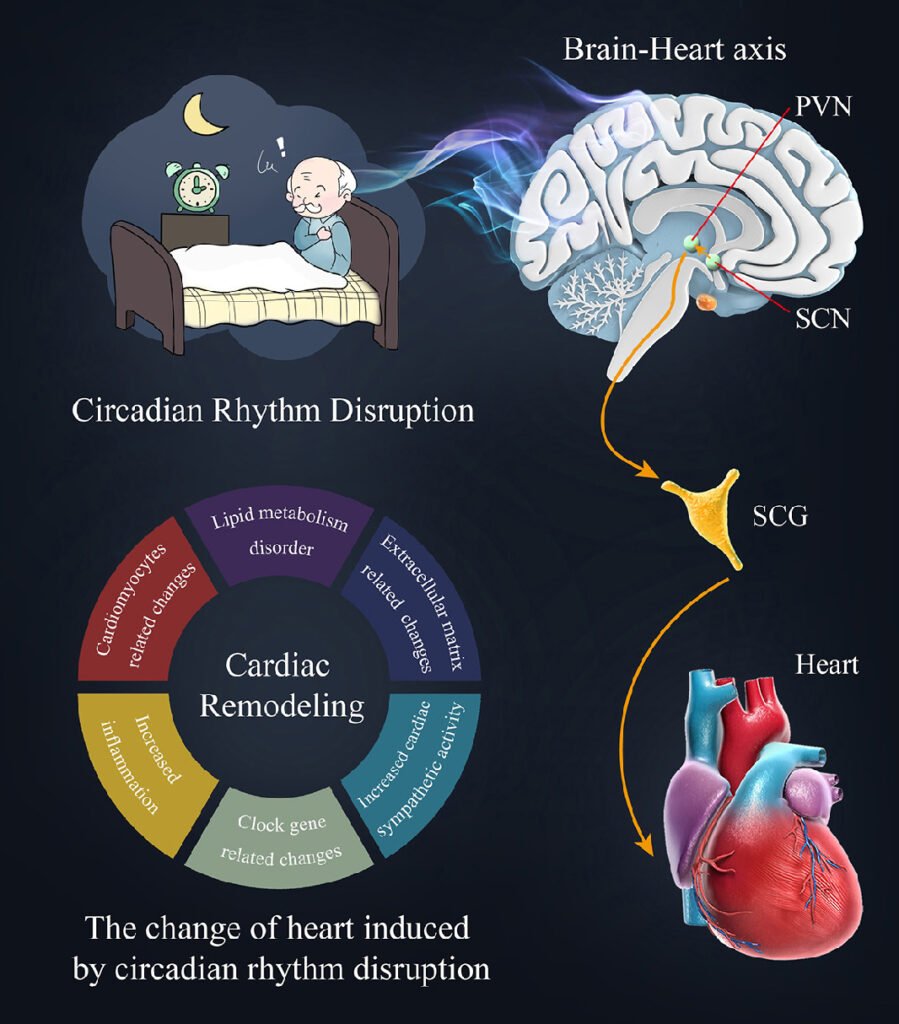 Diagram showing circadian rhythm disruption with a worried person in bed, brain-heart axis illustration, and a heart. Text on cardiac remodeling.